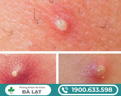 Hình ảnh minh họa